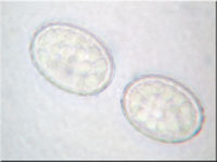 Scutellinia crinita