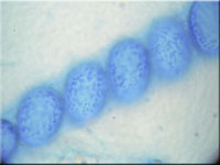 Scutellinia crinita