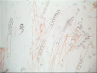 Holz-Schildborstling - Scutellinia scutellata