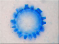 Sternsporiger Schildborstling - Scutellinia trechispora