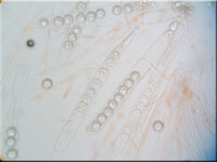 Sternsporiger Schildborstling - Scutellinia trechispora