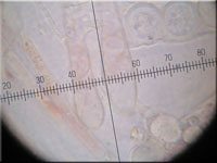 Sternsporiger Schildborstling - Scutellinia trechispora