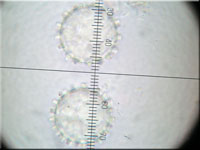 Sternsporiger Schildborstling - Scutellinia trechispora