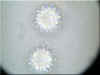Sternsporiger Schildborstling - Scutellinia trechispora