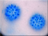 Sternsporiger Schildborstling - Scutellinia trechispora
