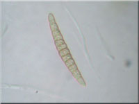 Brennnessel-Kugelpilz - Leptosphaeria acuta