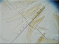 Wicken-Kugelpilz - Leptosphaeria modesta