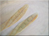 Wicken-Kugelpilz - Leptosphaeria modesta