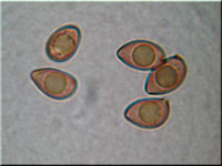 Braunvioletter Risspilz - Inocybe cincinnata