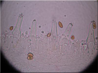 Frher Risspilz - Inocybe nitidiuscula