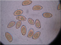 Frher Risspilz - Inocybe nitidiuscula