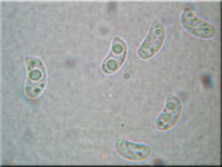 Buchenwald-Wasserfu - Hydropus subalpinus