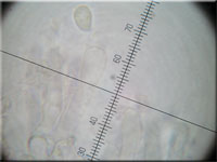 Schildflechten-Nabeling - Omphalina peltigerina
