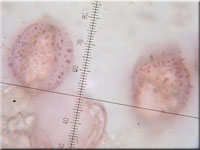 Aleurodiscus amorphus