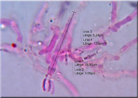 Alutaceodontia alutacea