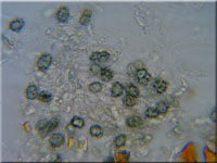 Amaurodon atrocyanea
