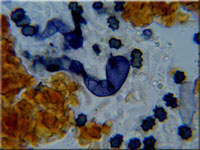 Amaurodon atrocyanea