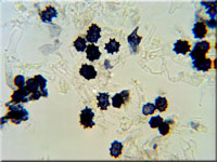 Amaurodon atrocyanea