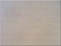 Amyloxenasma allantosporum