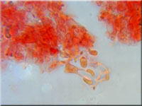 Amyloxenasma allantosporum