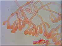 Athelia arachnoidea