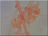Athelia arachnoidea