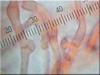 Faltiggewundener Wachsrindenpilz - Ceraceomyces serpens