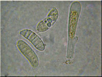 Verschiedensporige Gallerttr�ne - Dacrymyces variisporus