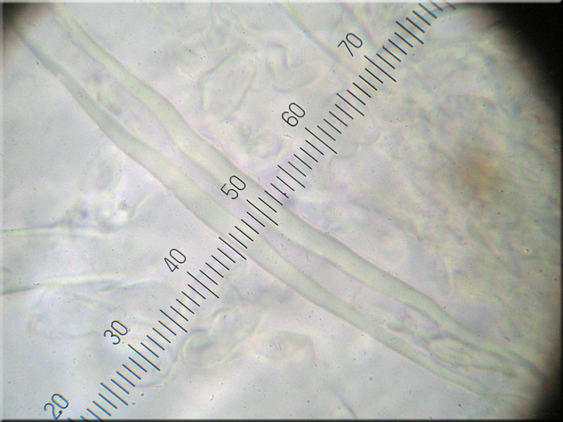 Jupiterbart - Hyphodontia barba-jovis