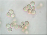 Stublings-Schleimpilz - Reticularia lycoperdon