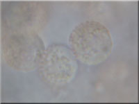 Stublings-Schleimpilz - Reticularia lycoperdon